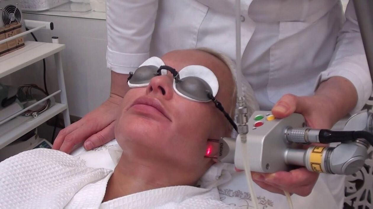 Tratamiento con rayo láser en áreas problemáticas de la piel del rostro. 
